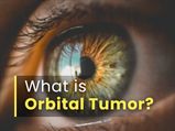 A Neurosurgeon Explains About Orbital Tumors: Diagnosis, Treatment & Management