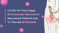 Avascular Necrosis Cases In COVID-19 Recovered Patients Due To The Use Of Steroids: All About The Condition