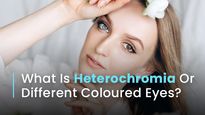 Can The Same Person Have Different Coloured Eyes? Causes, Symptoms And Treatment Of Heterochromia