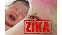 Zika Virus: Infants Exposed To The Virus May Develop Abnormalities In Spite Of Normal Assessment, Reports