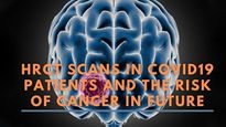 HRCT Scans In COVID-19 Patients And The Risk Of Cancer In Future
