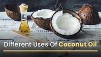 World Coconut Day 2022: 33 Different Uses Of Coconut Oil - Benefits, Allergies And How Much To Consume Per Day