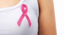 Expert Article: Breast Cancer Early Detection, Screening, And Management