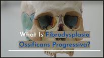 Fibrodysplasia Ossificans Progressiva: A Disease That Turns Flesh Into Bones