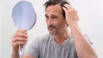 Dry Hair In Men: Causes And How To Manage It?