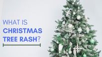 What Is Pityriasis Rosea Or Christmas Tree Rash? Causes And Symptoms