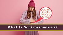What Is Schistosomiasis, An Endemic Parasitic Disease? Causes, Symptoms, Complications And Treatments
