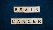 Expert Article: 7 Warning Signs Of Brain Tumour To Be Aware Of