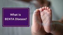 7-Month-Old Baby Diagnosed With Rare Genetic Disorder BENTA Disease: All About The Condition