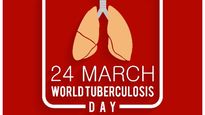 World TB Day 2022: FAQs On Tuberculosis Treatment And Its Link To COVID-19