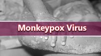 Monkeypox Virus Case Confirmed In UK After Nigeria Travel Link