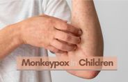 Monkeypox In Children: Symptoms To Watch Out For And More Details