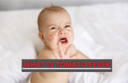 Tomato Fever Reported In Kerala: Know Causes, Symptoms, Treatment And Prevention