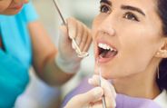 Expert Article: Say Goodbye To Yellow Teeth With Teeth Whitening