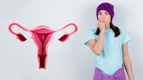 What Is Double Didelphys Or Double Uterus? Causes, Symptoms, Risk Factors And Treatments