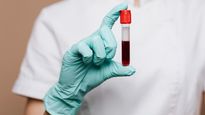 65-Year-Old Gujarat Man Detected With India's First And World's Rarest Blood Group