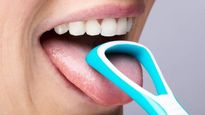 Expert Article: Is Your White Tongue A Matter Of Concern?