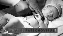 What Is Parechovirus? How To Know If Your Baby Has It? Signs, Symptoms, Causes And Treatment