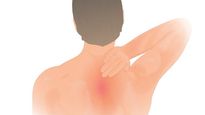 Winged Scapula - A Body Builder's Woe: Causes, Signs And Treatment