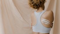 How To Get Rid Of Bacne AKA Back Acne: Home Remedies And Tips
