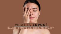 Lupus: What Causes This Autoimmune Condition? Types, Symptoms, Complications And Treatment