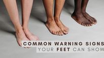 6 Common Warning Signs Your Feet Can Show About Your Health 