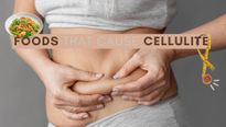 6 Types Of Foods That Can Cause Cellulite 
