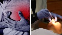 Expert Opinion: Oral Health And Cardiovascular Disease: A Surprising Connection
