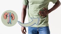 World Kidney Day 2023: Kidney Cysts: Know Causes, Symptoms, Treatment & Prevention