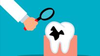 Understanding Reasons For Tooth Extraction: To Pull Or Not To Pull