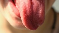 Tongue Is The Mirror Of Your Overall Health: Tongue Problems, How To Clean Your Tongue Effectively 