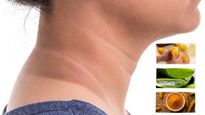 3 Home Remedies To Get Rid Of Blackening Around Neck