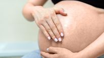 Discover Effective Tips to Prevent and Reduce Stretch Marks During Pregnancy!