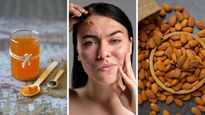 Back-to-Back Pimples? Your Diet May Be Missing These Three Foods!