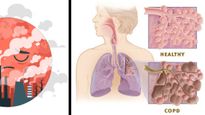 COPD And Exercise: Benefits Of Safe And Effective Exercise For People With COPD