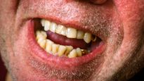 From Anxiety To Insecurity, What Dreams About Teeth Falling Out Reveal About You