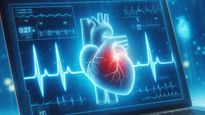 Transforming Lives With HAIF Heart Failure Predictor : FITTO Takes Cardiac Care To The Next Level With AI 