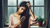 Monsoon Making You Bald? 3 Shocking Reasons Why Hairfall Gets Worse When It Starts Raining!