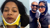 Racist Attack On Indian Couple In Switzerland: How Safe Are Indians When Travelling Overseas?                 