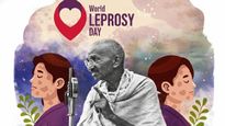 World Leprosy Day 2026: What Connects Mahatma Gandhi To Leprosy Awareness In India?