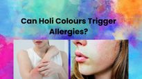 Holi 2026: Can Holi Colours Trigger Allergies? What Sensitive Skin Should Know