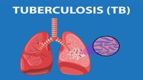 World Tuberculosis Day 2026: Date, Theme, History, and Significance Explained