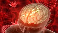 Kissing Disease Linked to 3x Higher Risk of Multiple Sclerosis: What You Should Know