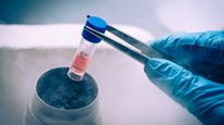Stem Cell Banking Explained: What Every Expecting Parent Should Know