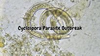 What Is Cyclospora? Inside The Parasite Outbreak Spreading Across The US