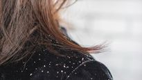 Monsoon Haircare: How To Tell If It's Monsoon Dandruff Or Something More Serious