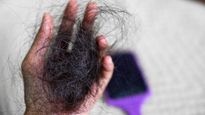 Is It Monsoon Hair Fall Or Something More Serious? How To Tell