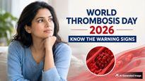 World Thrombosis Day 2026: Understanding Blood Clot Risks In Women And Their Warning Signs