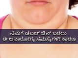 ನಿಮಗೆ ಡಬಲ್‌ ಚಿನ್‌ ಬರಲು ಈ ಅನಾರೋಗ್ಯ ಸಮಸ್ಯೆಗಳೇ ಕಾರಣ