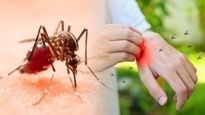 ವಿಶ್ವ ಮಲೇರಿಯಾ ದಿನ 2023: ಮಲೇರಿಯಾ ತಡೆಗಟ್ಟಲು ಸೊಳ್ಳೆ ಕಚ್ಚದಂತೆ ತಡೆಗಟ್ಟುವುದು ಹೇಗೆ?